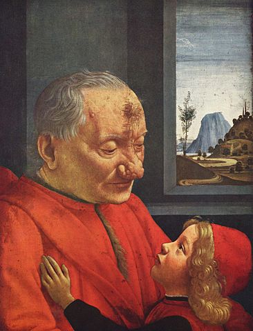 Rosazea (Knollennase/ Rhinophym) in der Kunstgeschichte