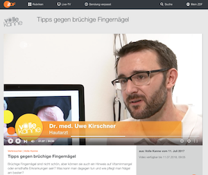 Dr. Kirschner (Mainz) im ZDF-Interview zu brüchigen Nägeln