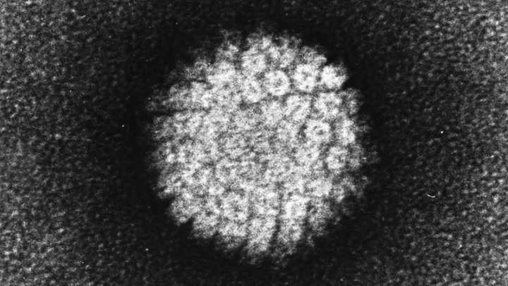 Bild eines Humanes Papillomvirus (HPV), welches ein Plattenepithelkarzinom auslösen kann