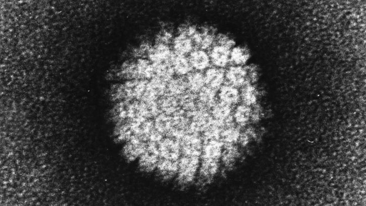 Bild eines Humanes Papillomvirus (HPV), welches ein Plattenepithelkarzinom auslösen kann