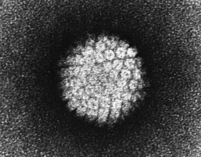Bild eines Humanes Papillomvirus (HPV), welches ein Plattenepithelkarzinom auslösen kann