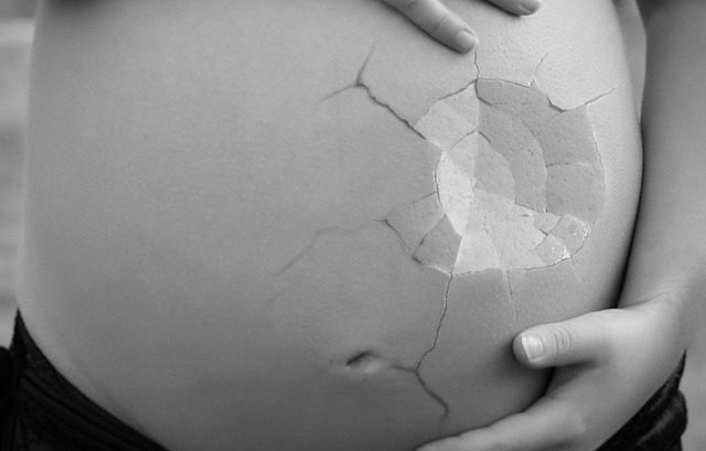 Hautveränderungen/ Hautprobleme in der Schwangerschaft