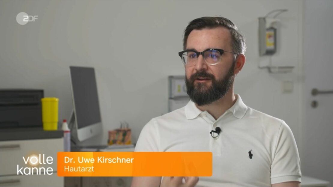 Dr. Kirschner, Haut- und Venenzentrum Mainz, im ZDF zu Laser gegen Nagelpilz (Nagellaser)