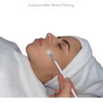 Rentinol Peeling